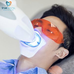 Tẩy trắng răng cho học sinh TPHCM