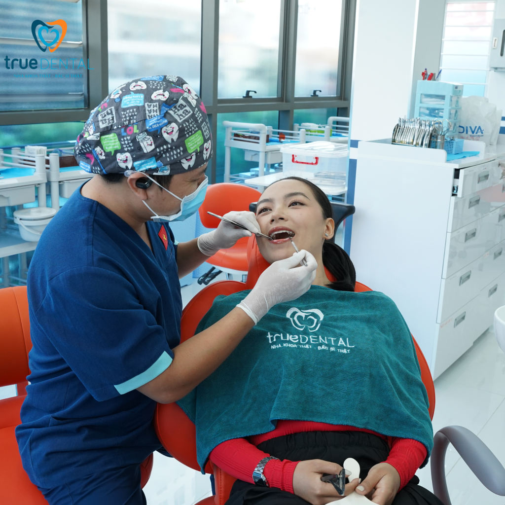Veneer cho người niềng xong chưa đẹp tại True Dental