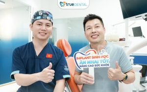 implant 4 răng cửa giá bao nhiêu