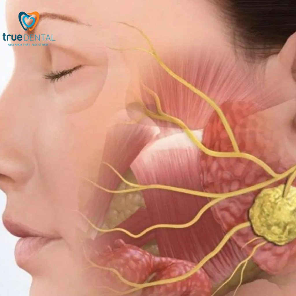 Bác sĩ Đỗ Thái Vĩnh Lai giải thích viêm khớp thái dương hàm điều trị ở đâu