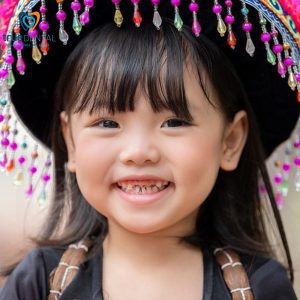 sún răng ở trẻ nhỏ có nguy hiểm không